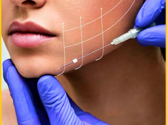 37-Thread, Face lift 37-Thread, Face lift