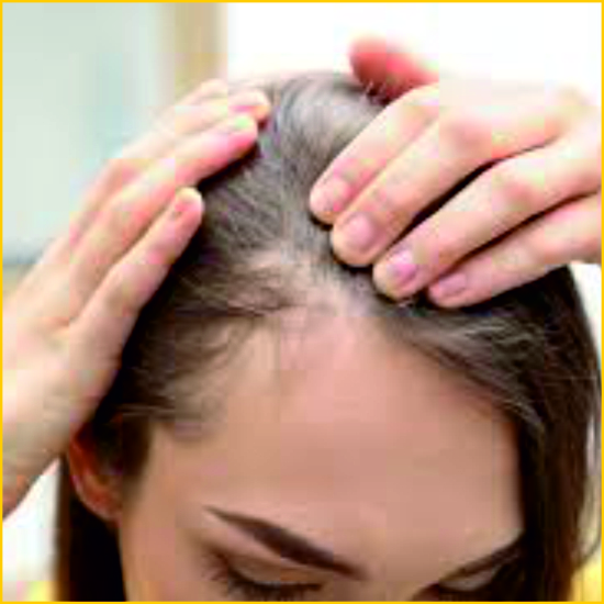 Alopecia areata treatment near me